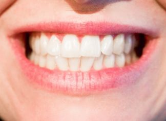 nadwrażliwość zębów