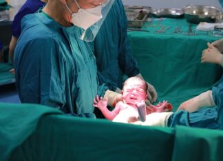 Ile kosztuje cięcie piła motorową drzewa?